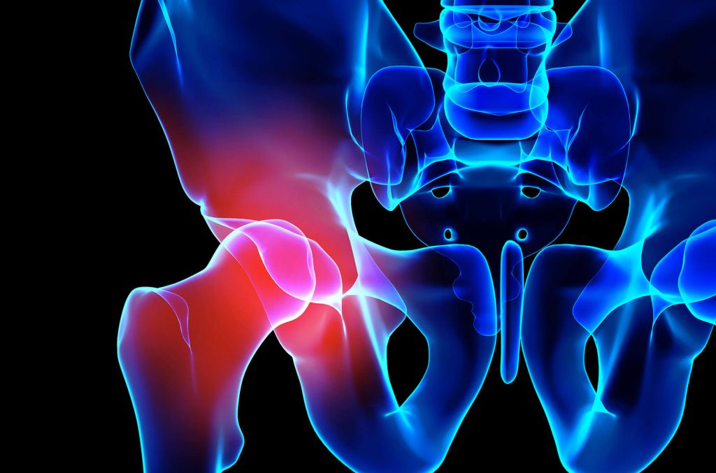 Hip Replacements at Centric Health Surgical Centre Toronto